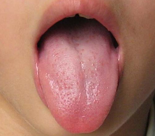 中医解析如何通过舌苔看健康 中医通过舌苔能看出什么