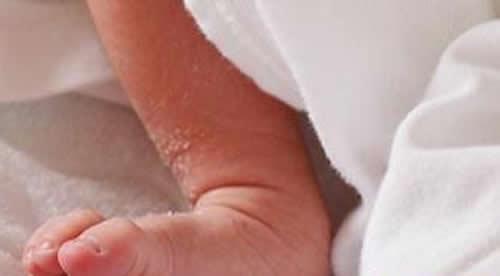 新生儿皮肤干燥怎么回事 新生儿皮肤干燥怎么办?