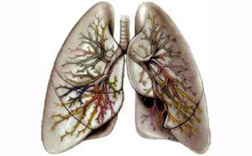 慢阻肺饮食要注意什么 慢阻肺日常饮食应注意什么