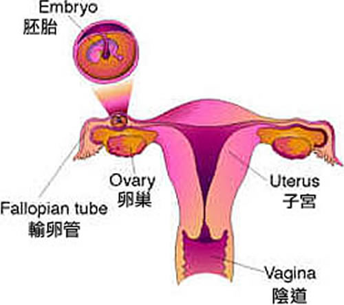 什么是宫外孕（什么是宫外孕症状早期）