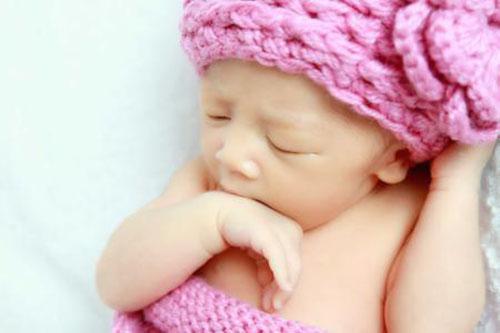 刚出生的婴儿怎么预防黄疸 怎样预防刚出生的宝宝黄疸