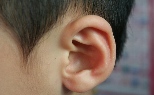耳洞发炎流脓怎么办 耳洞发炎流脓怎么办需要去耳钉吗