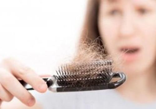脱发是什么原因引起的 脱发是什么原因引起的女性