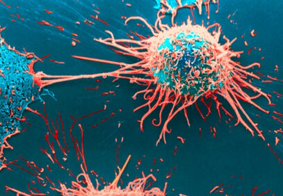 癌细胞可“感染”邻近细胞