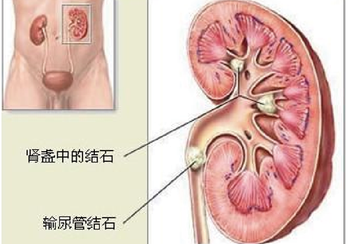 肚子胀尿少怎么回事（腹胀尿少是怎么回事）