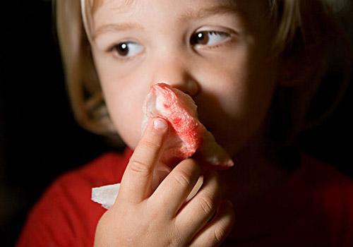 宝宝流鼻血是什么原因 开空调宝宝流鼻血是什么原因