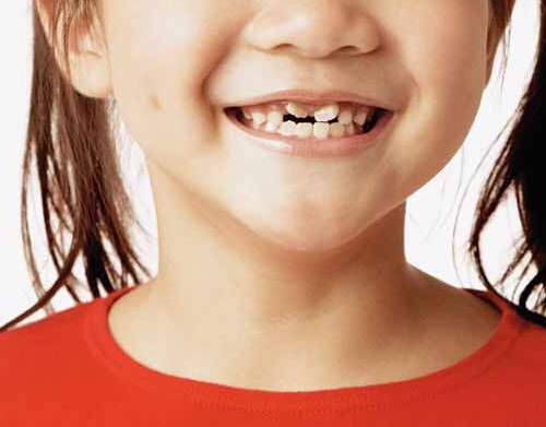 儿童换牙期间吃什么好 儿童换牙期间吃什么好些