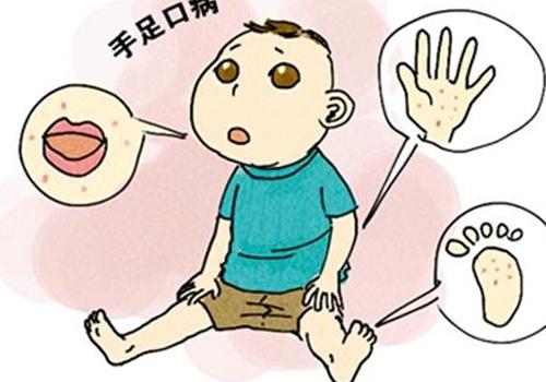 小孩手足口病几天会好 小孩手足口病多久会好