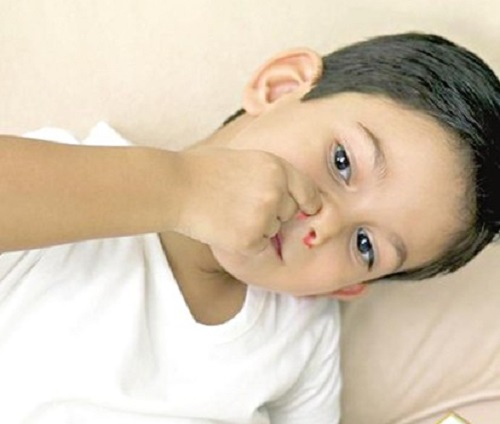小孩流鼻血的原因（小孩流鼻血的原因及治疗）
