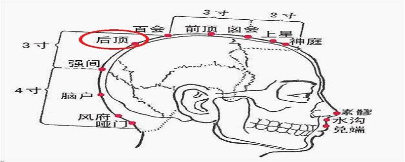 后顶在什么地方 后顶的准确位置