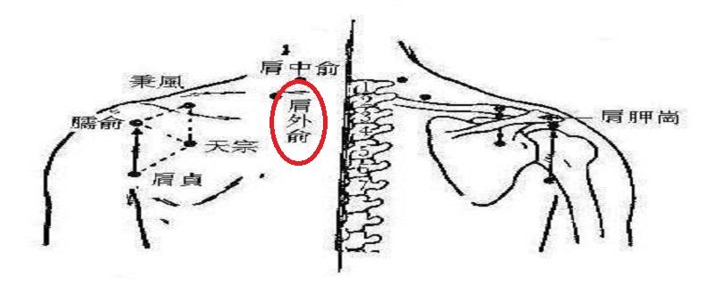 肩外俞在哪里 肩外俞的准确位置图片