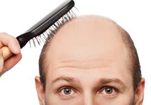 男性脱发是什么原因引起的（男性脱发是什么原因引起的一块）