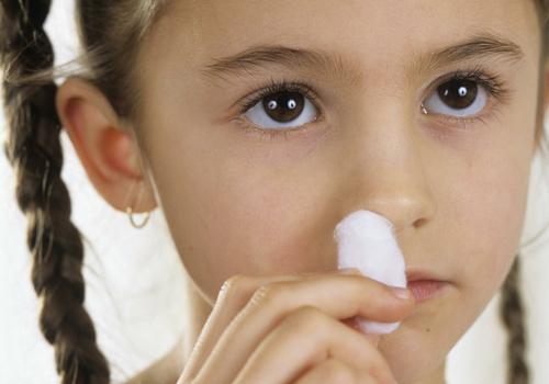 单侧鼻出血的常见原因 单侧鼻子频繁出血是什么原因