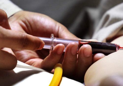 荨麻疹检查需要抽血吗 荨麻疹需要抽血化验吗?