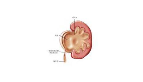 肾积水有哪些症状（肾积水有哪些症状 女性）