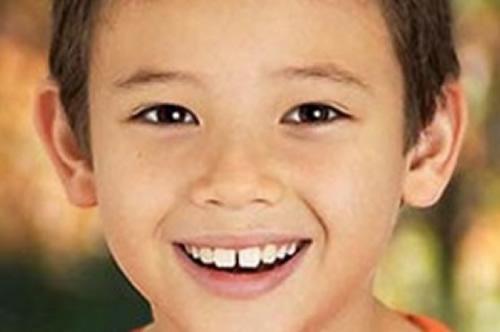 小孩换牙门牙中间有缝怎么办 儿童换牙大门牙中间有缝隙怎么办
