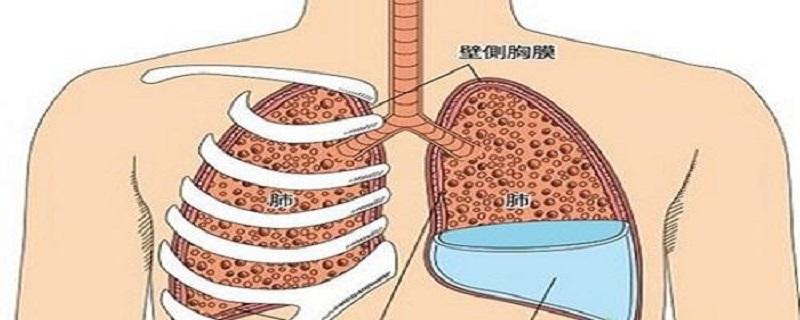 胸腔积液的症状有哪些 胸膜炎胸腔积液的症状有哪些