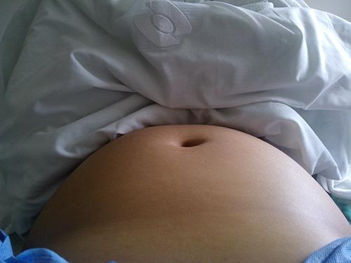 怀孕能不能吃腐竹 怀孕能不能吃腐竹和豆腐