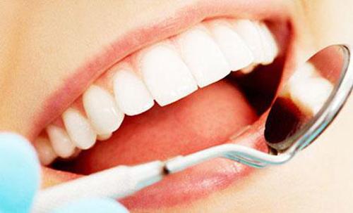关于洗牙的一些问题 洗牙需要注意的问题
