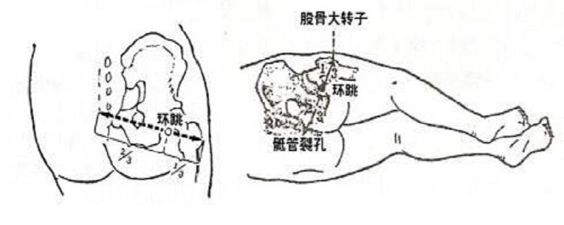 环跳的准确位置图视频（环跳位置图片）