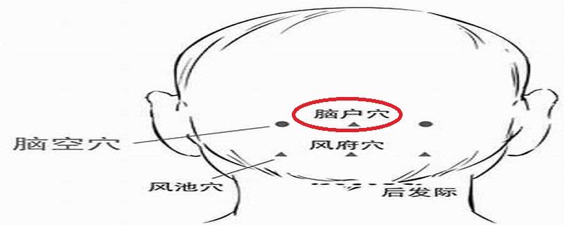 脑户的位置图片 脑户的准确位置图片