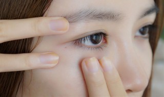 怎样去掉眼角皱纹 去掉眼角皱纹的方法