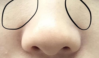 鼻子短怎么办 有这三种延长方法