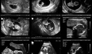 如何可以看到胎儿的头和尾 靠摸可以判断出胎儿头脚