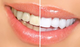 牙黄怎么变白 怎么让牙齿变白