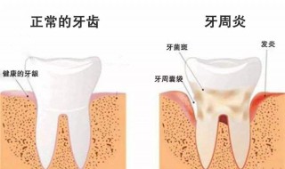牙齿松动固定方法 牙齿松动能不能固定