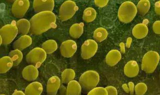 假丝酵母菌有哪些症状 外阴阴道假丝酵母菌病的临床表现及诊断