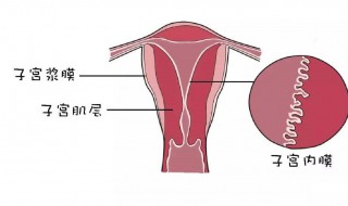 子宫松弛有哪些症状 宫颈内口松弛症有哪些症状
