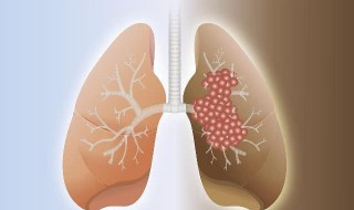 肺不好坚持养肺的三个方法 一定对养肺护肺有帮助
