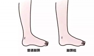 脚踝消肿的方法 脚踝肿胀的分类