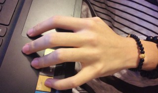 手腕手指有痣代表什么 手腕上有痣代表什么?