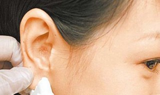 小孩子打耳洞发炎了怎么办 打耳洞发炎了怎么办