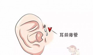 人类的耳屎是怎么形成的 耳屎是怎么形成的