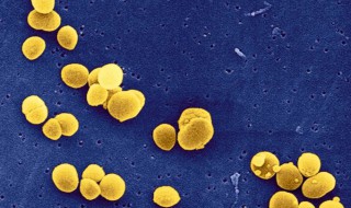金黄色葡萄球菌防护措施 金黄色葡萄糖菌预防措施