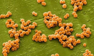 金黄色葡萄球菌是什么 金黄色葡萄球菌是什么症状