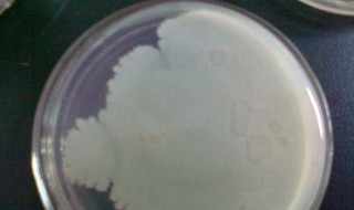 为什么酵母菌计数时,先盖盖玻片,再滴培养液 酵母菌计数为什么先盖盖玻片