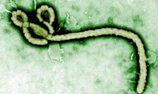 埃博拉是什么 埃博拉是什么病