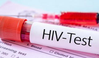 去医院如何检测艾滋病 如何检测艾滋病
