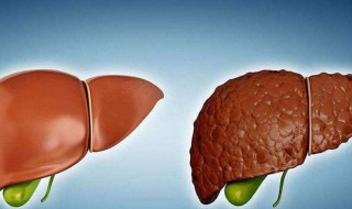 如何养护肝脏 如何养护肝脏?