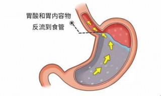 怎样养胃护胃 怎样养胃护胃好