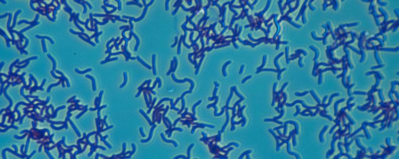 碘能否杀弧菌，弧菌是什么 创伤弧菌用碘伏能杀死吗