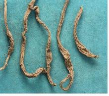黄花菜根的功效与作用 黄花菜根的功效与作用及食用方法