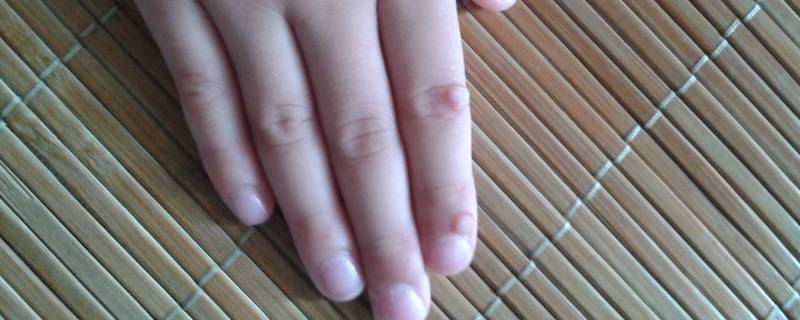 拇指是哪个手指 左手拇指是哪个手指
