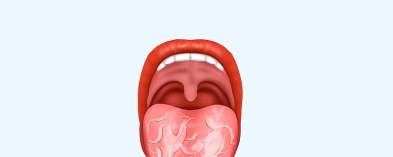 裂纹舌不能吃什么东西 舌头上面有裂纹吃什么能好