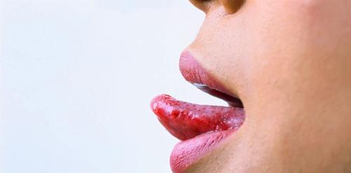 舌癌的早期症状和前兆 舌癌的早期症状