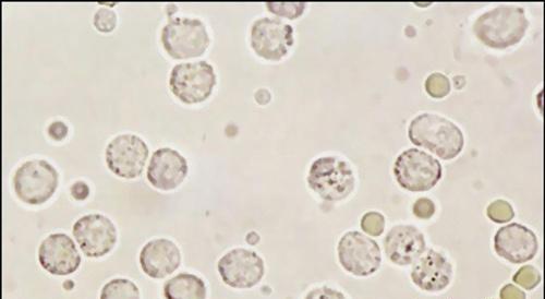白细胞偏低的原因 白细胞偏低的原因是什么